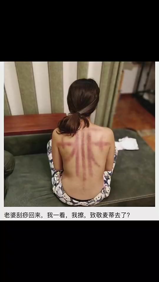 老婆这刮痧是去致敬麦